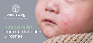 5 Common Skin Issues in Babies and How Ayurveda Can Help