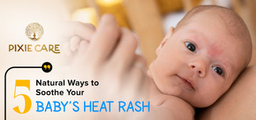 5 Natural Ways to Soothe Your Baby’s Heat Rash